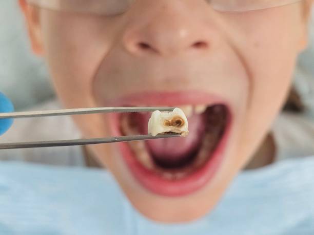 Best Emergency Dentist Open Today  in Colona, IL